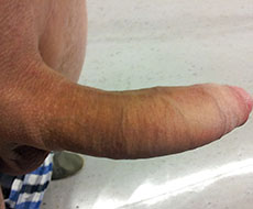 Fattest cock
