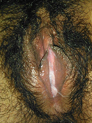 furry pussy