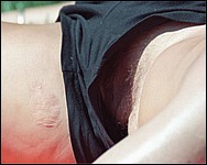 Deadly drunk teens afterparty! Click to see more!