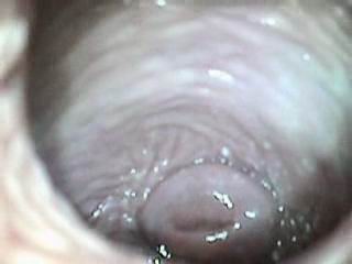 #1 video sample