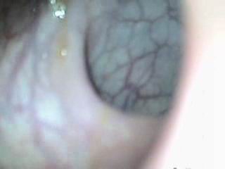 #3 video sample