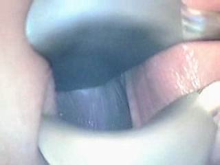 #1 video sample
