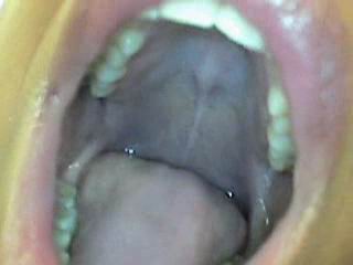 #1 video sample