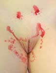 tits in pain