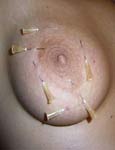 tits in pain