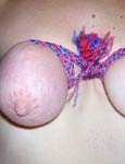 pussy pain