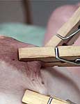 needle play