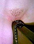 sadism