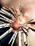 edgeplay