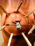 bondage