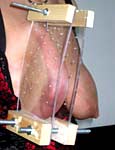 tits in pain