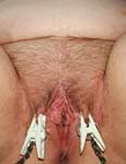 pussy pain