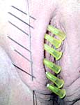 bondage