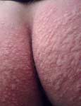 tits in pain
