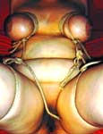 bondage