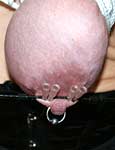 pussy pain