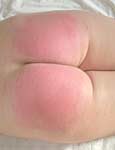 tits in pain