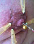 pussy pain