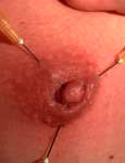 pussy pain