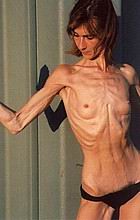 zskinny31.jpg