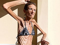 pro-ana-skinny-girls16.jpg