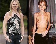 veryskinny11.jpg