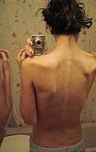 xxxskinny07.jpg