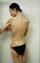 xxxskinny01.jpg