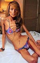 xxxskinny04.jpg