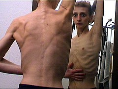anoretic01.jpg