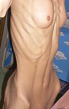 xxxskinny44.jpg
