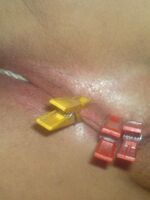 amateur bondage tgp