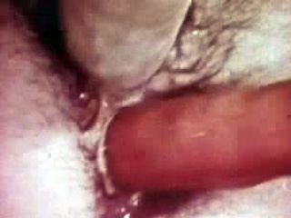 vintage anal