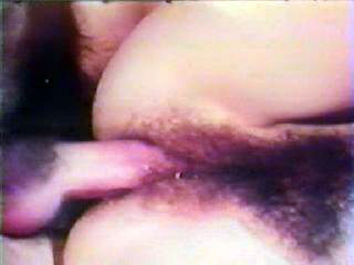 retro anal