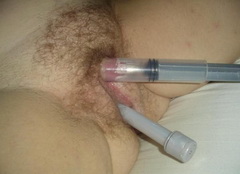 Plump Fisting