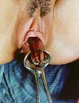 sadism