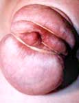 pussy pain