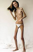 xskinny87.jpg