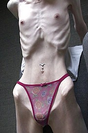 proana-bony-girls03.jpg