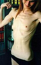 zskinny38.jpg