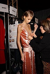 anorexia_victims07.jpg