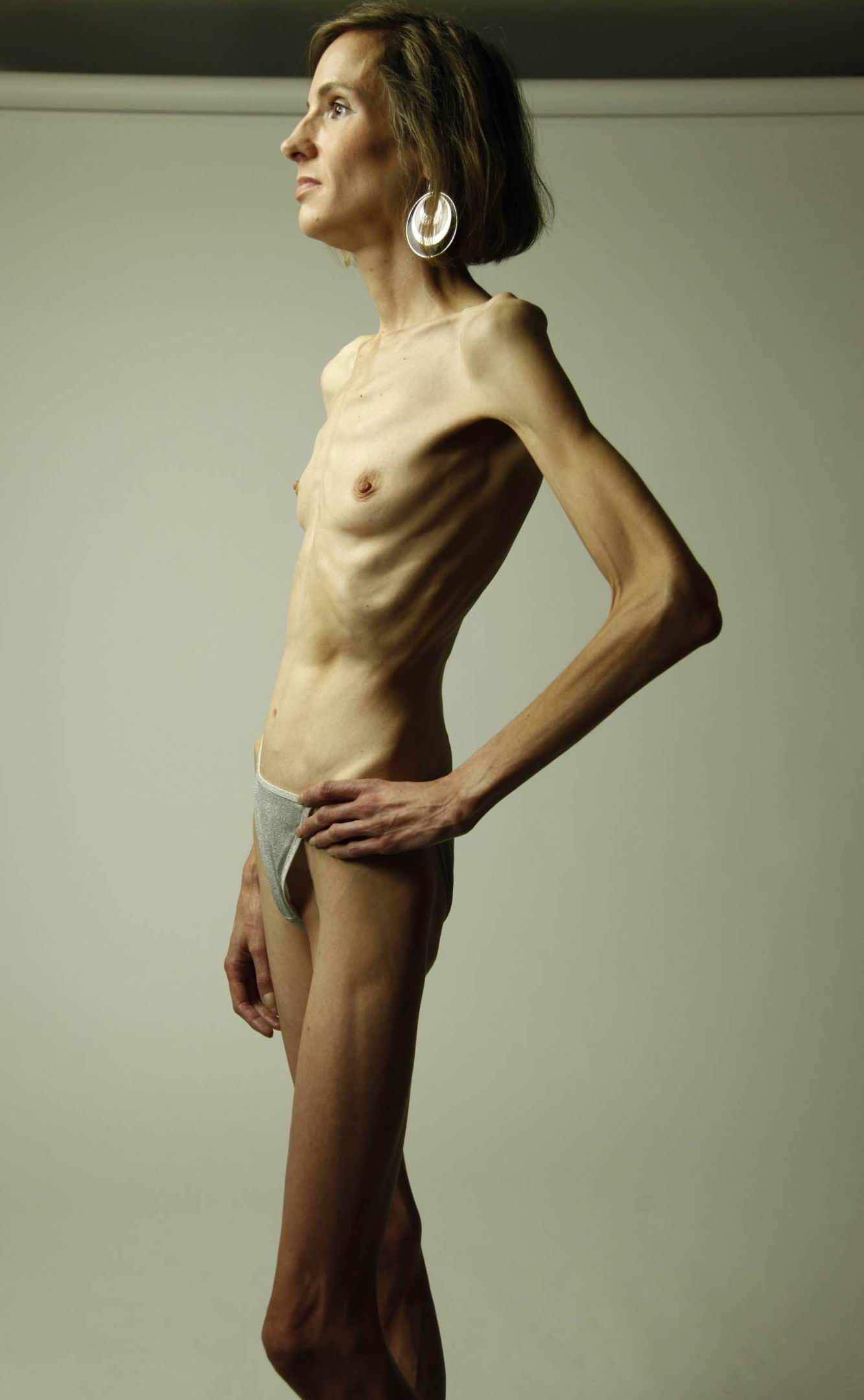 Sexy anorexic women naked pics — img 3