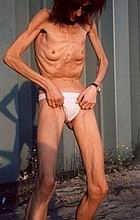 xxxskinny16.jpg
