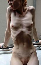 xxxskinny17.jpg