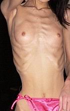 xxxskinny18.jpg